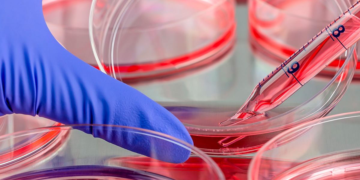 Размножение клеток пуповинной крови –  результаты 3 фазы исследований