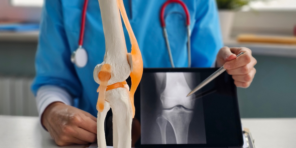 Клетки пупочного канатика эффективны в лечении артроза коленного сустава