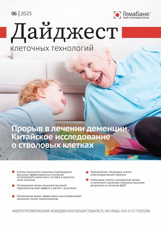 Дайджест №06, 2025г. - Прорыв в лечении деменции.  Китайское исследование  о стволовых клетках